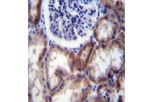 Immunohistochemistry analysis in formalin fixed and paraffin embedded human kidney tissue reacted with HYAL2 / Hyaluronidase-2 Antibody (Center) followed by peroxidase conjugation of the secondary antibody and DAB staining.