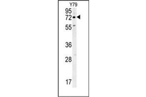 RFT1 Antikörper  (C-Term)