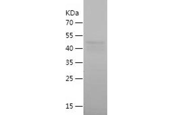 R-Spondin 3 Protein (RSPO3) (AA 24-272) (His-IF2DI Tag)