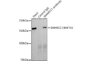 Immunoprecipitation analysis of 300 μg extracts of HepG2 cells using 3 μg SM/B antibody . (SMARCC1 Antikörper)