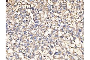 IHC analysis of AASS using anti-AASS antibody (ABIN7601519). (AASS Antikörper  (AA 37-865))