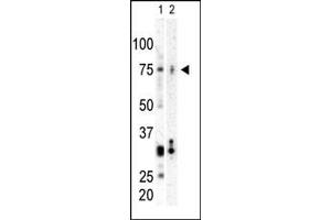 Western blot analysis of anti-CNK Pab (ABIN392602 and ABIN2842130) in SK-BR3 cell lysate (Lane A) and mouse heart tissue lysate (Lane B). (PLK3 Antikörper  (C-Term))