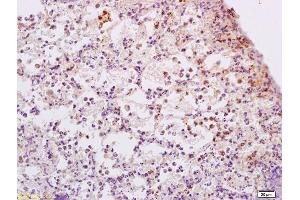 Formalin-fixed and paraffin embedded rat lung tissue labeled with Anti-ADCY9 Polyclonal Antibody, Unconjugated (ABIN751243) at 1:200 followed by conjugation to the secondary antibody and DAB staining (ADCY9 Antikörper  (AA 251-350))
