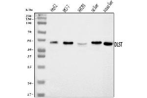 Western blot analysis of DLST using anti-DLST antibody (ABIN7599412). (DLST Antikörper  (AA 1-453))