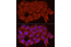 Immunofluorescence (IF) image for anti-Caspase 7, Apoptosis-Related Cysteine Peptidase (CASP7) (AA 24-303) antibody (ABIN3022072)
