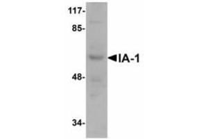 Image no. 1 for anti-Insulinoma-Associated 1 (INSM1) (N-Term) antibody (ABIN478172) (INSM1 Antikörper  (N-Term))