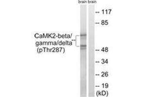 Western blot analysis of extracts from rat brain, using CaMK2-beta/gamma/delta (Phospho-Thr287) Antibody. (CaMK2 beta/gamma/delta (AA 253-302), (pThr287) Antikörper)