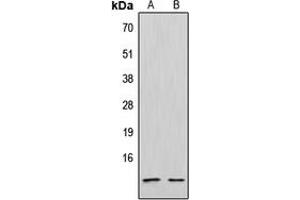 Western blot analysis of CXCL12 expression in Jurkat (A), NCIH292 (B) whole cell lysates. (CXCL12 Antikörper  (C-Term))