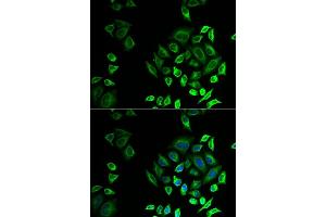 Immunofluorescence analysis of U2OS cells using PLG2D antibody (ABIN6132162, ABIN6145727, ABIN6145729 and ABIN6222983). (PLA2G2D Antikörper  (AA 21-145))