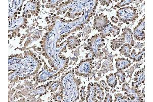 IHC analysis of Glutathione Reductase using anti-Glutathione Reductase antibody (ABIN5693151).