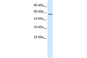 WB Suggested Anti-TPH2 Antibody Titration:  0. (Tryptophan Hydroxylase 2 Antikörper  (N-Term))