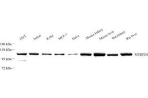 Western Blotting (WB) image for anti-Methylenetetrahydrofolate Dehydrogenase (NADP+ Dependent) 1, Methenyltetrahydrofolate Cyclohydrolase, Formyltetrahydrofolate Synthetase (MTHFD1) antibody (ABIN7074609)