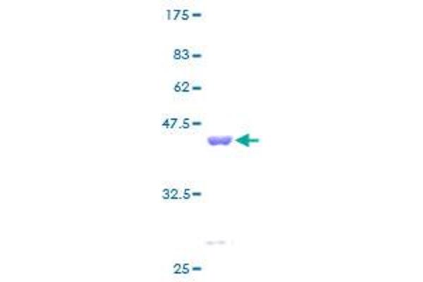 RPS12 Protein (AA 1-132) (GST tag)