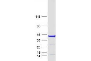 Western Blotting (WB) image for Tubulin Folding Cofactor C (TBCC) protein (Myc-DYKDDDDK Tag) (ABIN2733289)
