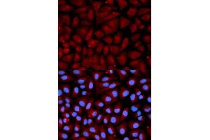 Immunofluorescence analysis of U2OS cells using SERPINC1 antibody. (SERPINC1 Antikörper  (AA 33-185))