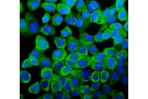 IF analysis of YB1 using anti-YB1 antibody (ABIN3043966). (YBX1 Antikörper  (C-Term))