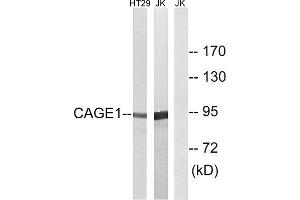 Western Blotting (WB) image for anti-Cancer Antigen 1 (CAGE1) (C-Term) antibody (ABIN1850982) (CAGE1 Antikörper  (C-Term))