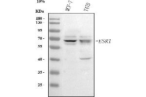 Western blot analysis of Estrogen Receptor using anti-Estrogen Receptor antibody (ABIN3042378).