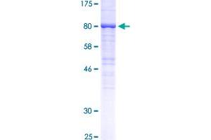 Image no. 1 for Epidermal Growth Factor Receptor (EGFR) (AA 669-1210) protein (GST tag) (ABIN1352441)