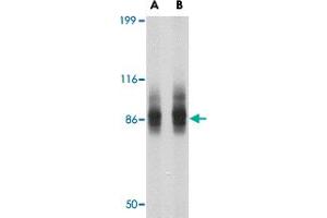 Western blot analysis of SP110 in SW480 cell lysate with SP110 polyclonal antibody  at (A) 1 and (B) 2 ug/mL . (SP110 Antikörper  (N-Term))