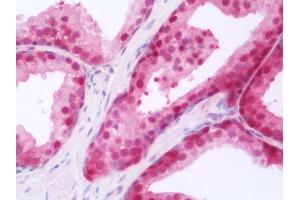 Anti-RARG / RAR-Gamma antibody IHC staining of human prostate.