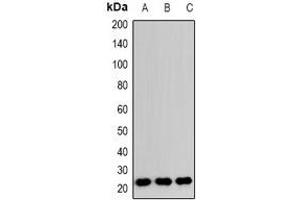 Western blot analysis of RAB24 expression in HeLa (A), RAW264. (RAB24 Antikörper)