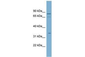 Image no. 1 for anti-Solute Carrier Family 5 (Sodium/glucose Cotransporter), Member 9 (SLC5A9) (N-Term) antibody (ABIN6743203)