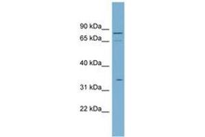 Image no. 1 for anti-Solute Carrier Family 5 (Sodium/glucose Cotransporter), Member 9 (SLC5A9) (N-Term) antibody (ABIN6743203) (SLC5A9 Antikörper  (N-Term))