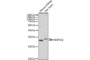 Western blot analysis of extracts of various cell lines, using ADIPOQ antibody (ABIN3016228, ABIN3016229, ABIN3016230 and ABIN6219638) at 1:500 dilution. (ADIPOQ Antikörper  (AA 19-104))