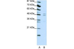 Western Blot showing TANK antibody used at a concentration of 1-2 ug/ml to detect its target protein. (TANK Antikörper  (C-Term))