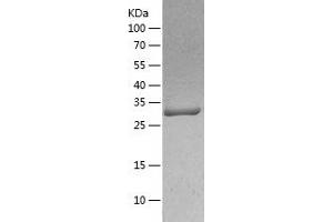 Western Blotting (WB) image for Mitochondrial Ribosomal Protein L1 (MRPL1) (AA 51-325) protein (His tag) (ABIN7288673) (MRPL1 Protein (AA 51-325) (His tag))