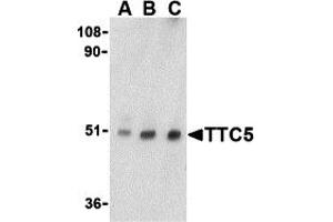 Western Blotting (WB) image for anti-Tetratricopeptide Repeat Domain 5 (TTC5) (C-Term) antibody (ABIN1030785) (TTC5 Antikörper  (C-Term))