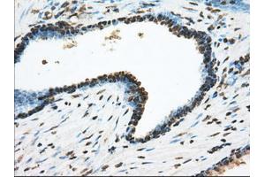 Immunohistochemical staining of paraffin-embedded Kidney tissue using anti-ACSBG1 mouse monoclonal antibody. (ACSBG1 Antikörper)