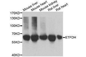 Western blot analysis of extracts of various cell lines, using ETFDH antibody. (ETFDH Antikörper)