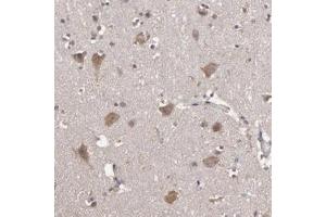 Immunohistochemical staining of human cerebral cortex with HECTD1 polyclonal antibody  shows moderate positivity in neurons at 1:50-1:200 dilution.