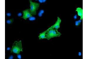 Anti-CCM2 mouse monoclonal antibody (ABIN2454943) immunofluorescent staining of COS7 cells transiently transfected by pCMV6-ENTRY CCM2 (RC201418). (CCM2 Antikörper)