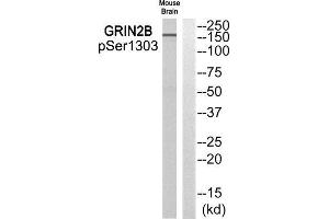Western Blotting (WB) image for anti-Glutamate Receptor, Ionotropic, N-Methyl D-Aspartate 2B (GRIN2B) (pSer1303) antibody (ABIN1847839) (GRIN2B Antikörper  (pSer1303))