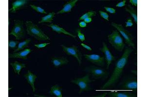 Immunofluorescence of monoclonal antibody to TRIP6 on HeLa cell. (TRIP6 Antikörper  (AA 1-100))