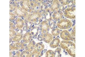 Immunohistochemistry of paraffin-embedded Rat kidney using PSMD9 Polyclonal Antibody at dilution of 1:200 (40x lens). (PSMD9 Antikörper)