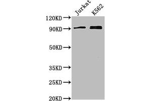 Western Blot Positive WB detected in: Jurkat whole cell lysate, K562 whole cell lysate All lanes: MARK2 antibody at 1:2000 Secondary Goat polyclonal to rabbit IgG at 1/50000 dilution Predicted band size: 88, 79, 84, 82, 81, 78, 87, 83, 80 kDa Observed band size: 88 kDa (MARK2 Antikörper  (AA 373-594))