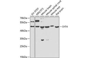 Western blot analysis of extracts of various cell lines, using SYT4 antibody (ABIN6129135, ABIN6148791, ABIN6148792 and ABIN6223676) at 1:1000 dilution. (SYT4 Antikörper  (AA 38-190))
