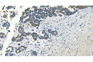 IHC analysis of IDH2 using anti-IDH2 antibody (ABIN7602786).