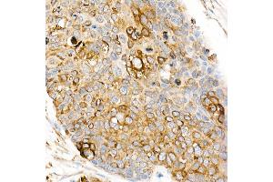 Immunohistochemistry (IHC) image for anti-Fas Ligand (TNF Superfamily, Member 6) (FASL) (AA 100-200) antibody (ABIN3020742)