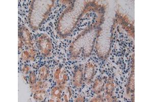 IHC-P analysis of stomach tissue, with DAB staining. (Keratin 3 Antikörper  (AA 198-514))