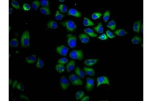 Immunofluorescence staining of Hela cells with ABIN7163832 at 1:200, counter-stained with DAPI. (PKD1 Antikörper  (AA 615-753))