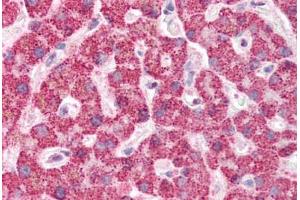 Human Liver (formalin-fixed, paraffin-embedded) stained with IFIH1 antibody ABIN337077 at 5 ug/ml followed by biotinylated goat anti-rabbit IgG secondary antibody ABIN481713, alkaline phosphatase-streptavidin and chromogen. (IFIH1 Antikörper  (Internal Region))