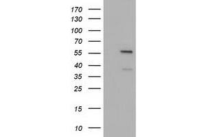 HEK293T cells were transfected with the pCMV6-ENTRY control (Left lane) or pCMV6-ENTRY DYNC1LI1 (Right lane) cDNA for 48 hrs and lysed. (DYNC1LI1 Antikörper)