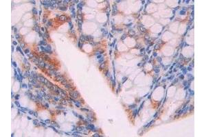 Immunohistochemistry (IHC) image for anti-CD47 (CD47) (AA 18-219) antibody (ABIN7439102)