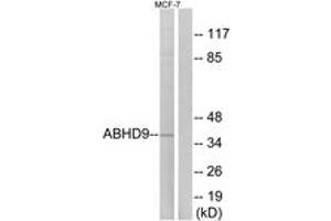 Western blot analysis of extracts from MCF-7 cells, using ABHD9 Antibody. (ABHD9 Antikörper  (AA 101-150))