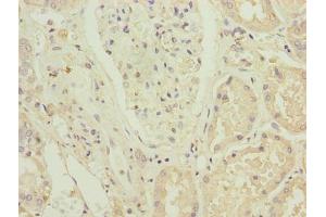 Immunohistochemistry of paraffin-embedded human kidney tissue using ABIN7176421 at dilution of 1:100 (ZNF596 Antikörper  (AA 201-504))